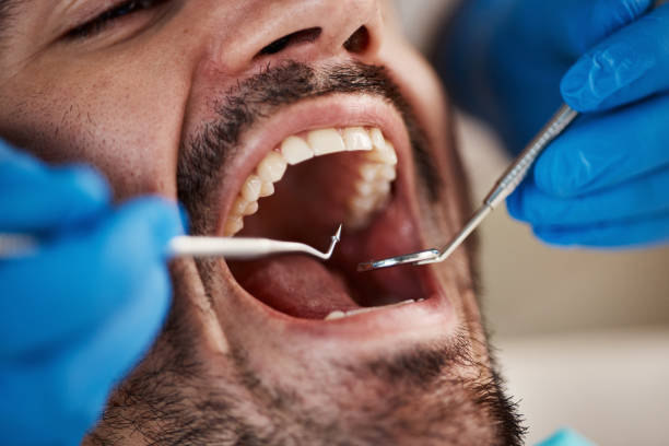 Best After-Hours Dental Trauma Care in Rafter J Ranch, WY